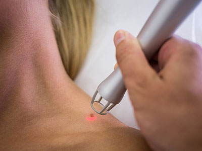 Can Red Light Therapy Really Remove and Prevent Scars?